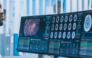 16 slice vs 64 slice ct scan